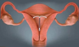 上环视频,揭秘上环视频背后的故事